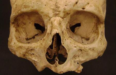 Death Perception: The Science of Forensic Anthropology Image